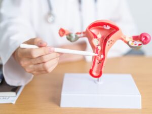 fase dilatante utero: un medico illustra le dinamiche di questa fase utilizzando un utero ricreato in plastica